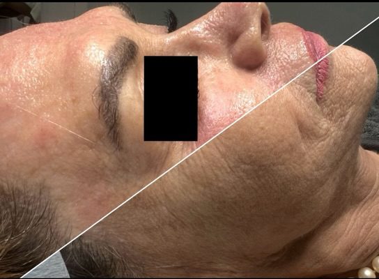 A client’s face split diagonally into before and after.