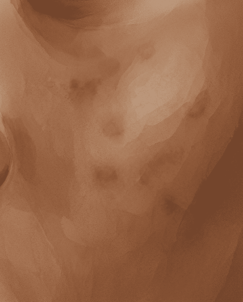 Watercolour illustration of deep, melanin-rich skin with soft post-inflammatory marks.